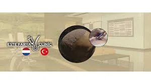 Este Farya Clinic | Saç Ekim Merkezi