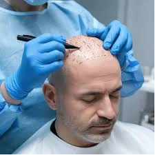 Dragos Hair Saç Ekim Merkezi