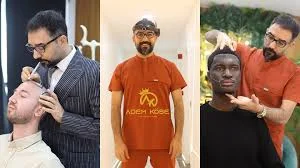 Adem Köse - Hair Transplant Turkey
