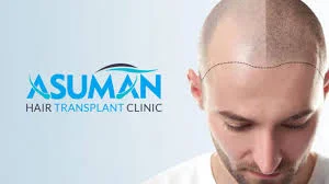 Asuman Hair - Fotoğraf 1