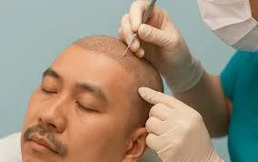 Arz Hair Center Saç Ekim Merkezi