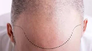 Silivri Hair Center - Fotoğraf 1