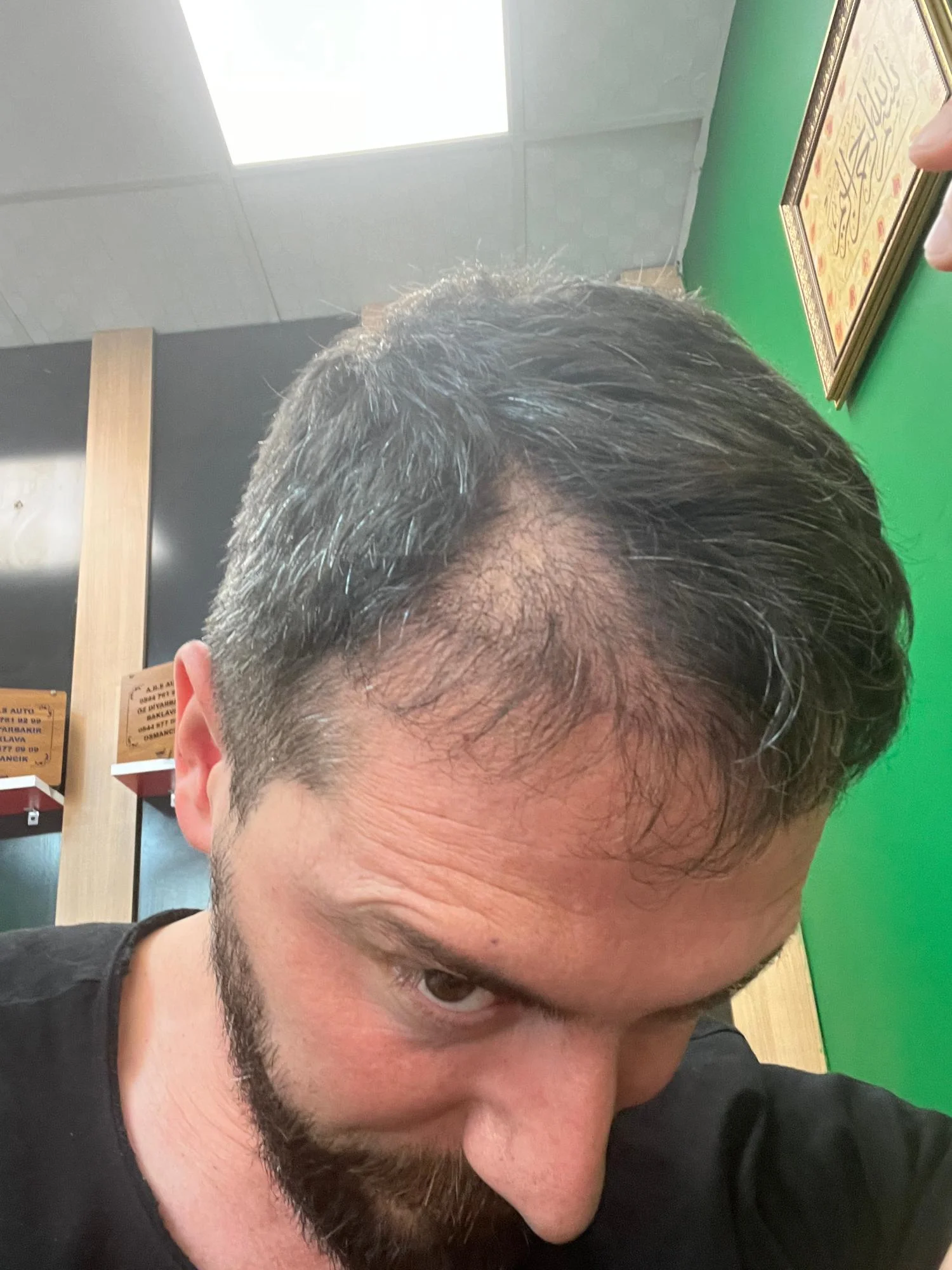 Hair Chiefs - Fotoğraf 1