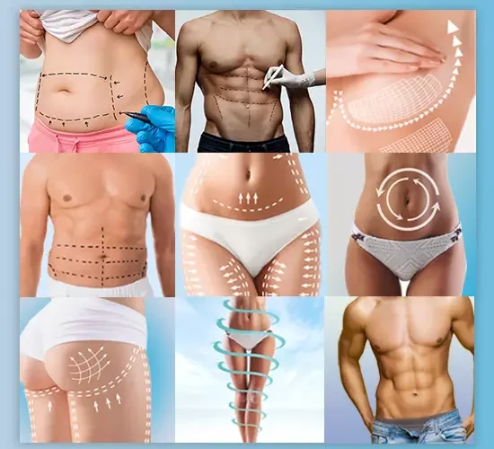 Doç Dr. Gökhan Temiz | Estetik Cerrahi Kliniği